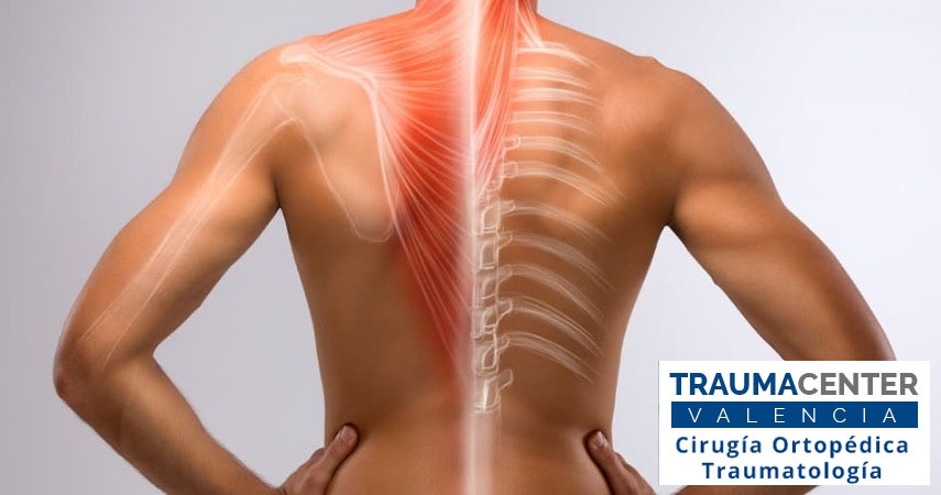 Cómo eliminar el dolor de espalda