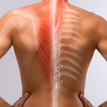 Tratamientos del dolor de espalda. La rizolisis