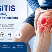 Bursitis: causas, síntomas, diagnóstico y tratamiento